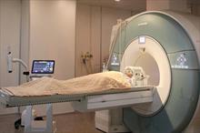 Khi nào cần gây mê để chụp MRI?